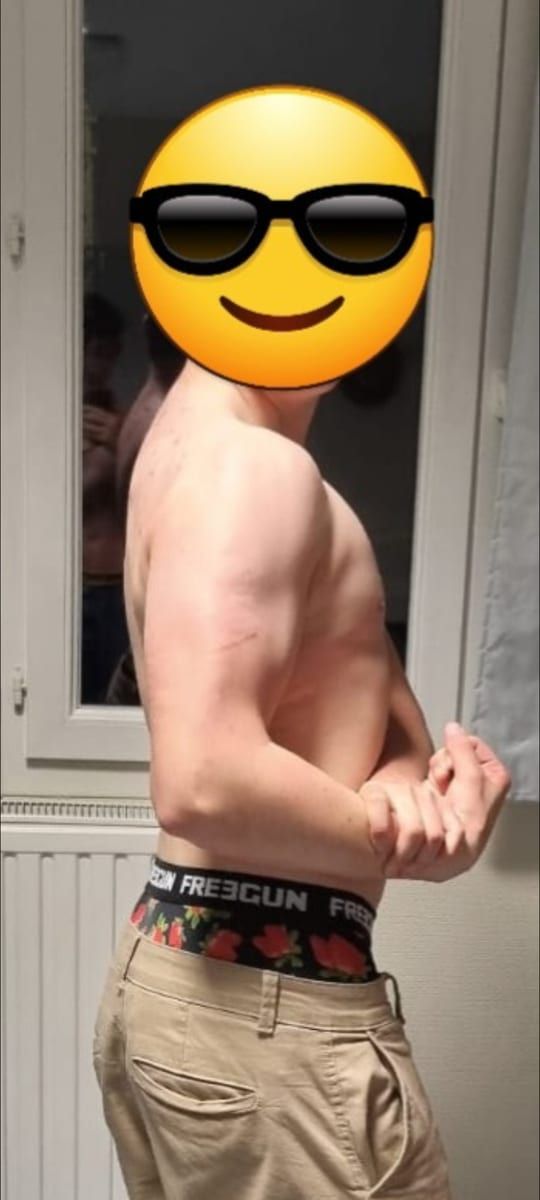 Profil de Ness